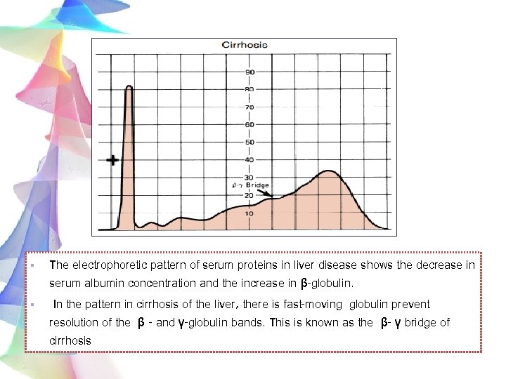 § The electrophoretic pattern of serum proteins in liver disease shows the decrease in