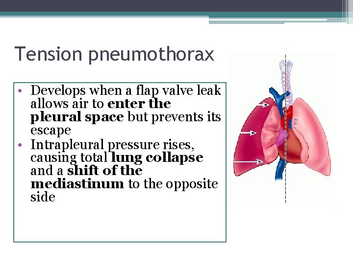 Tension pneumothorax • Develops when a flap valve leak allows air to enter the