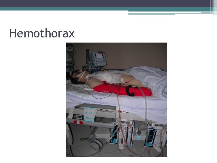 Hemothorax 