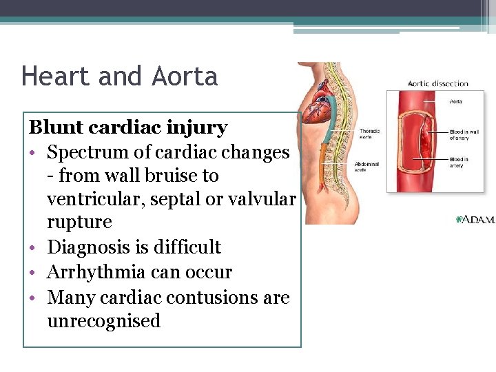 Heart and Aorta Blunt cardiac injury • Spectrum of cardiac changes - from wall