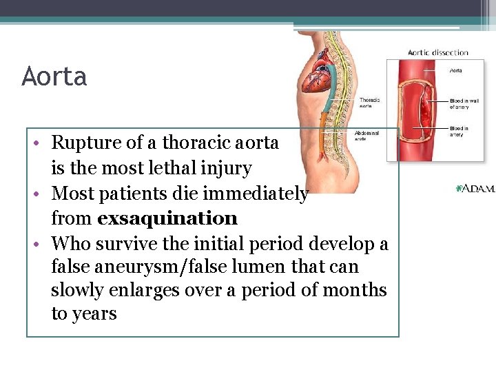 Aorta • Rupture of a thoracic aorta is the most lethal injury • Most