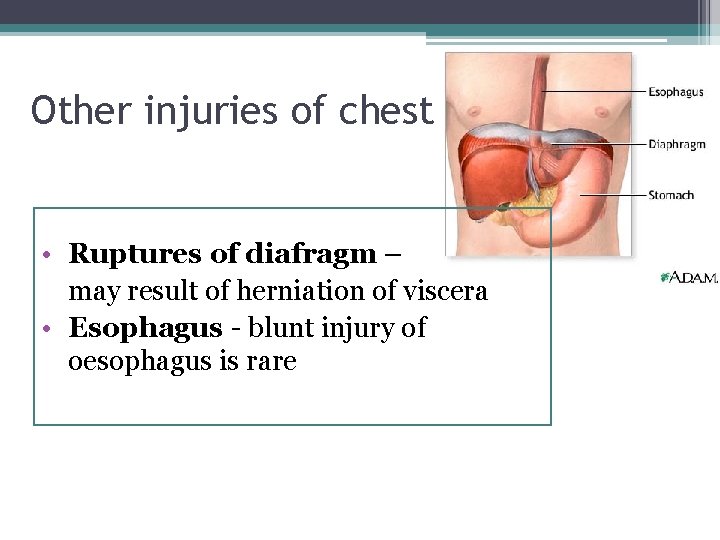 Other injuries of chest • Ruptures of diafragm – may result of herniation of