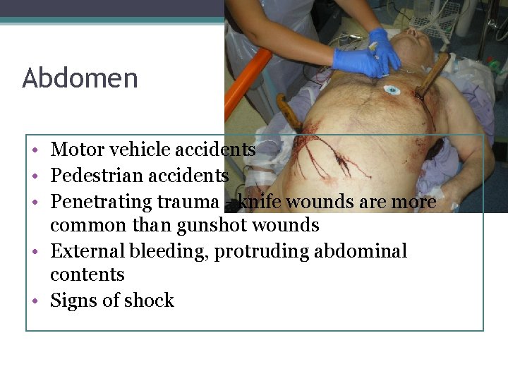 Abdomen • Motor vehicle accidents • Pedestrian accidents • Penetrating trauma - knife wounds