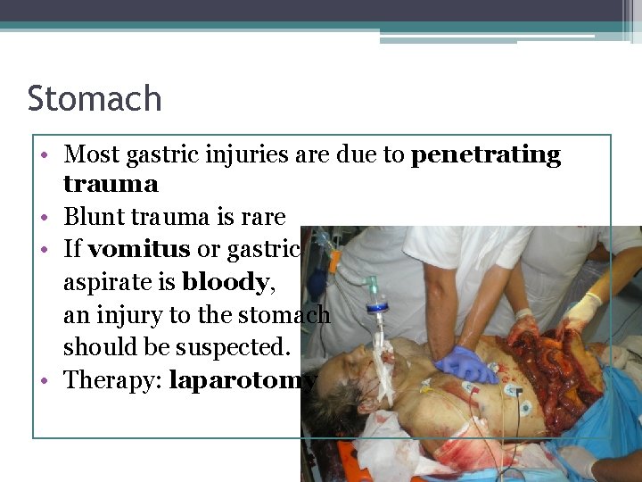 Stomach • Most gastric injuries are due to penetrating trauma • Blunt trauma is