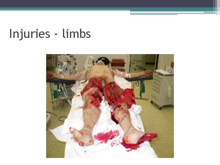 Injuries - limbs 