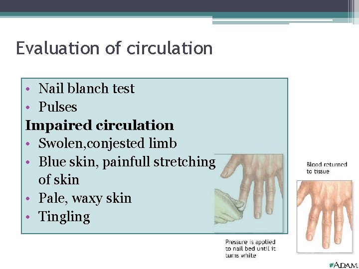 Evaluation of circulation • Nail blanch test • Pulses Impaired circulation • Swolen, conjested
