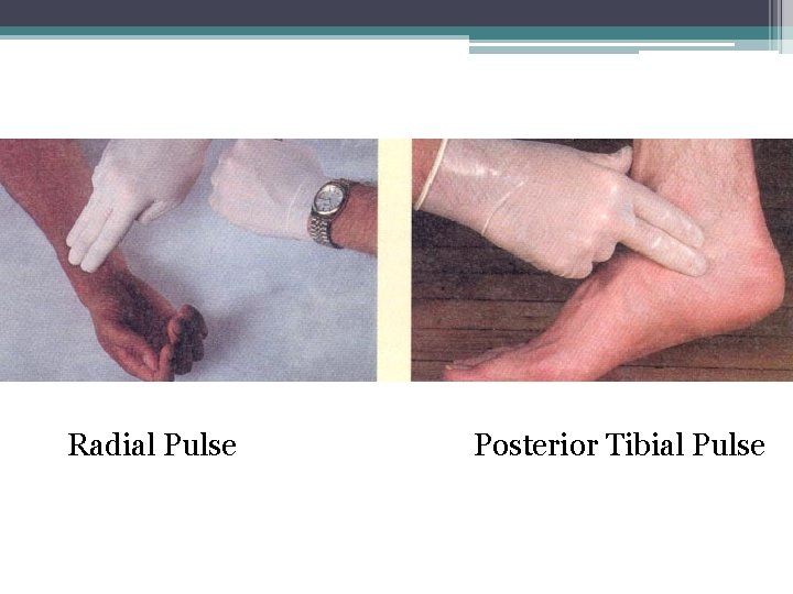 Radial Pulse Posterior Tibial Pulse 