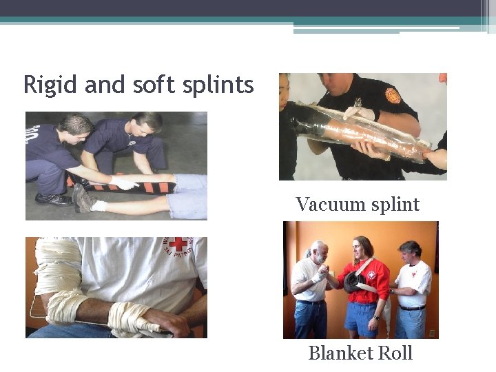 Rigid and soft splints Vacuum splint Blanket Roll 