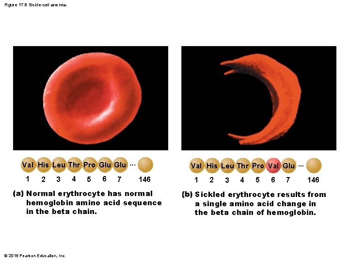 Figure 17. 8 Sickle-cell anemia. Val His Leu Thr Pro Glu. . . 1