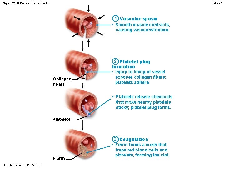 Slide 1 Figure 17. 13 Events of hemostasis. 1 Vascular spasm • Smooth muscle