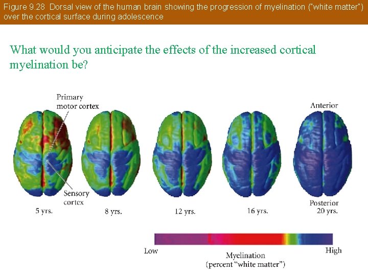 Figure 9. 28 Dorsal view of the human brain showing the progression of myelination