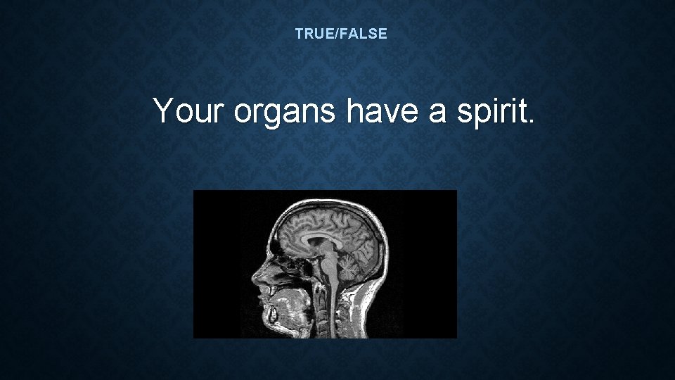 TRUE/FALSE Your organs have a spirit. TRUE/FALSE Your organs have a spirit.
