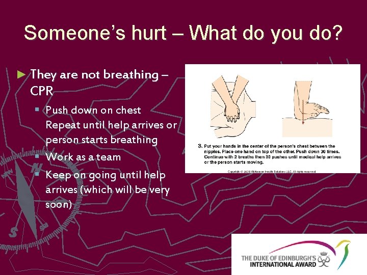 Someone’s hurt – What do you do? ► They are not breathing – CPR