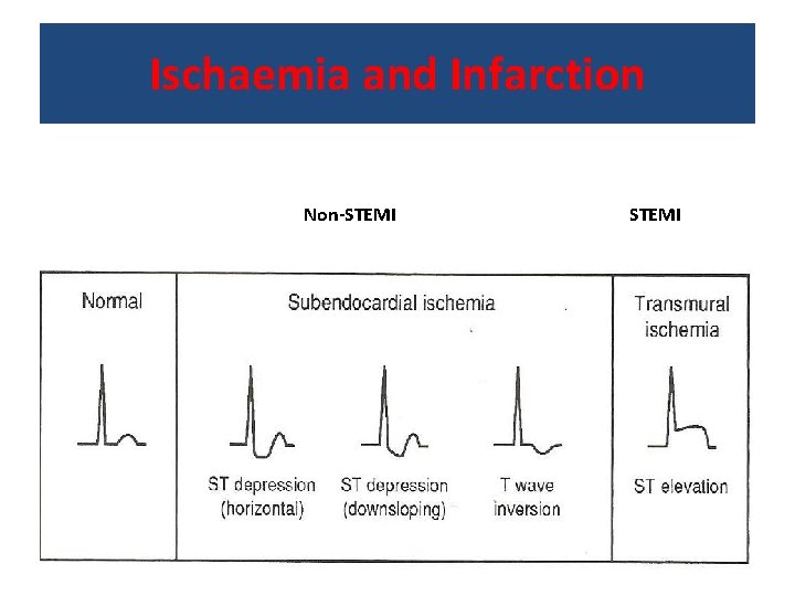 Ischaemia and Infarction Non-STEMI 