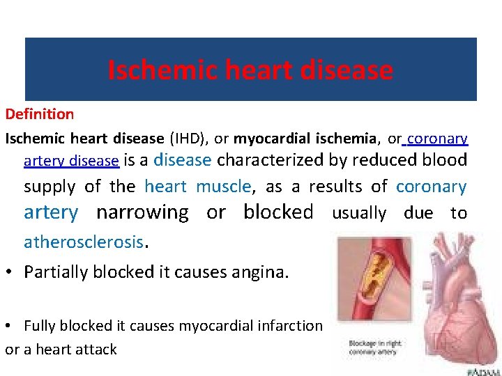 Ischemic heart disease Definition Ischemic heart disease (IHD), or myocardial ischemia, or coronary artery