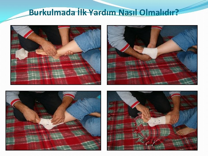 Burkulmada İlk Yardım Nasıl Olmalıdır? Burkulmada İlk Yardım Nasıl Olmalıdır?