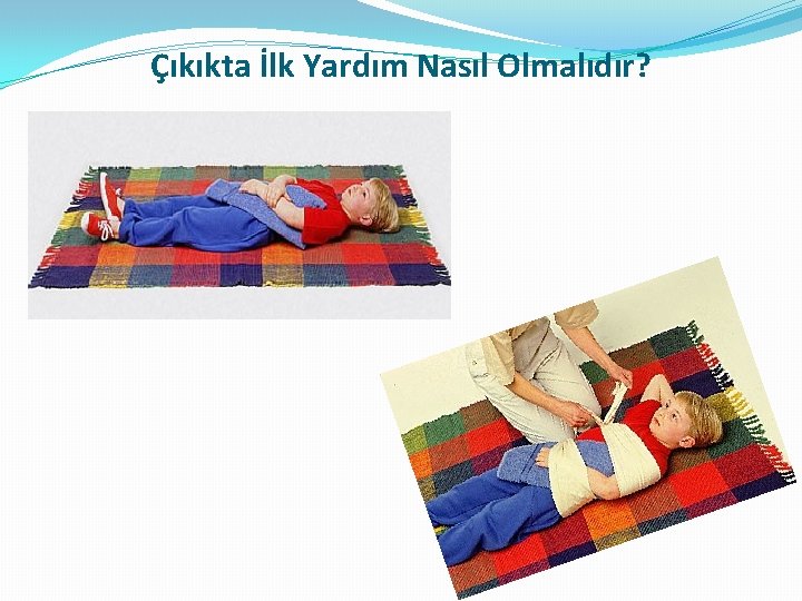 Çıkıkta İlk Yardım Nasıl Olmalıdır? Çıkıkta İlk Yardım Nasıl Olmalıdır?