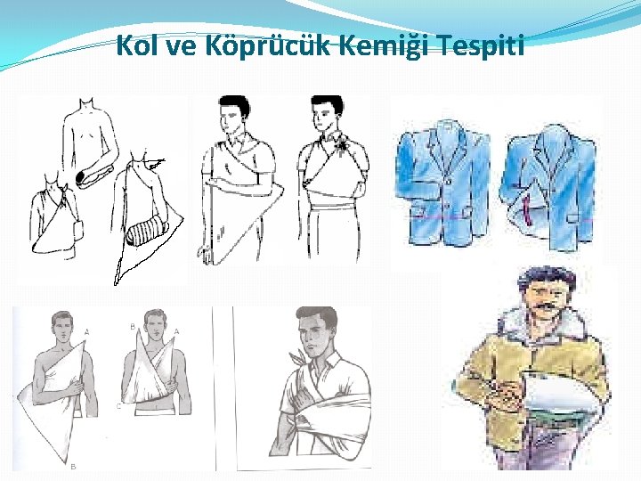 Kol ve Köprücük Kemiği Tespiti Kol ve Köprücük Kemiği Tespiti