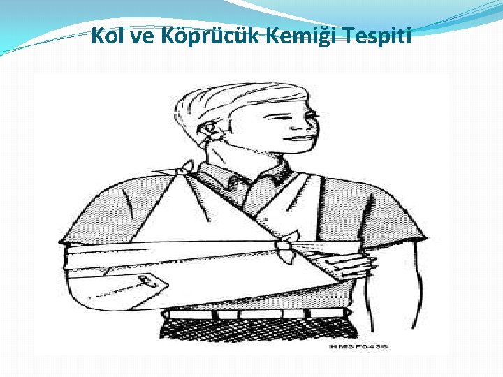 Kol ve Köprücük Kemiği Tespiti Kol ve Köprücük Kemiği Tespiti