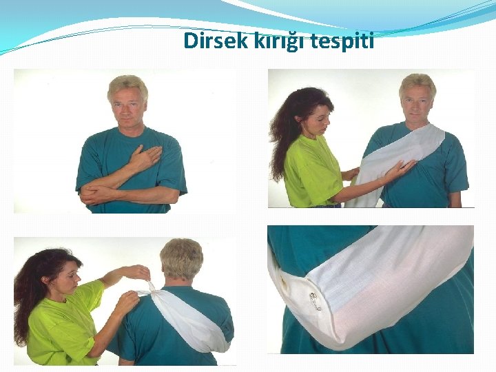 Dirsek kırığı tespiti Dirsek kırığı tespiti