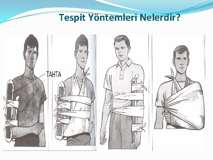 Tespit Yöntemleri Nelerdir? Tespit Yöntemleri Nelerdir?