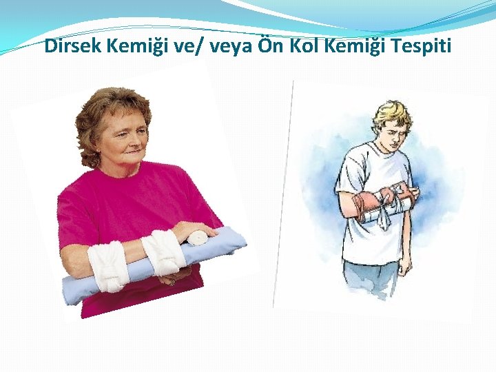 Dirsek Kemiği ve/ veya Ön Kol Kemiği Tespiti Dirsek Kemiği ve/ veya Ön Kol Kemiği Tespiti