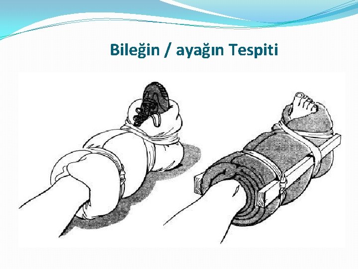 Bileğin / ayağın Tespiti Bileğin / ayağın Tespiti