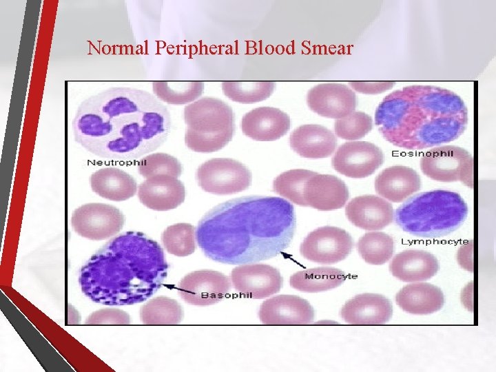 Normal Peripheral Blood Smear 