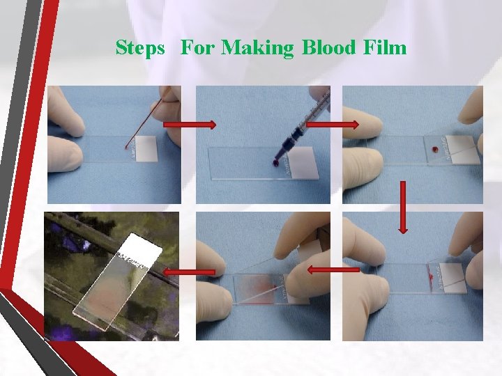 Steps For Making Blood Film 