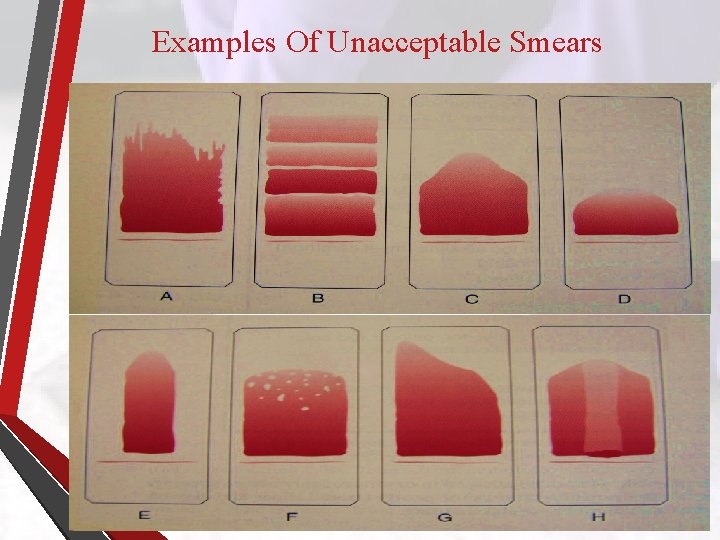 Examples Of Unacceptable Smears 
