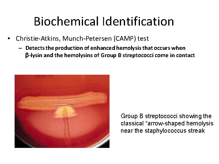 Biochemical Identification • Christie-Atkins, Munch-Petersen (CAMP) test – Detects the production of enhanced hemolysis