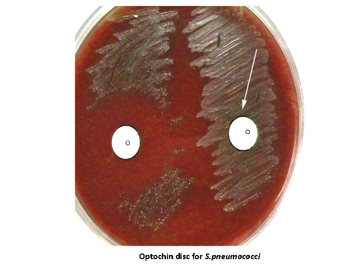 Optochin disc for S. pneumococci 