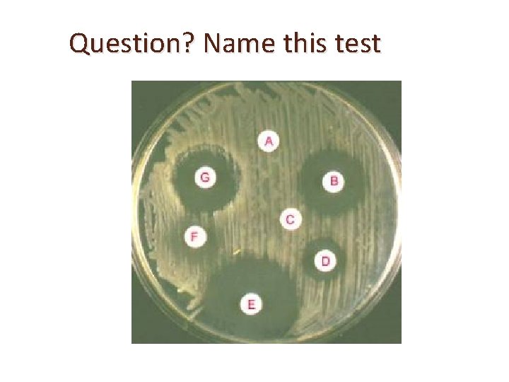 Question? Name this test 