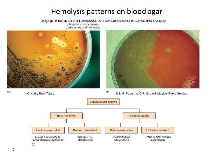 Hemolysis patterns on blood agar 7 