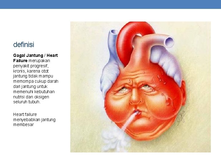 definisi Gagal Jantung / Heart Failure merupakan penyakit progresif, kronis, karena otot jantung tidak