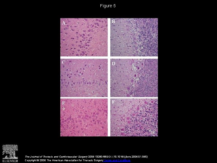 Figure 5 The Journal of Thoracic and Cardiovascular Surgery 2006 13280 -88 DOI: (10.