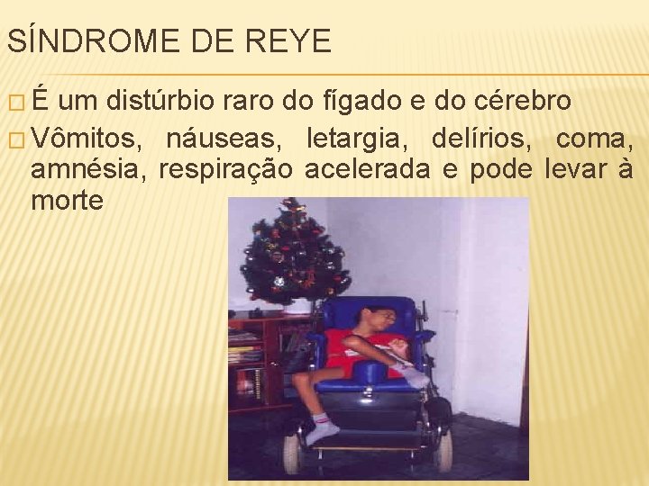 SÍNDROME DE REYE �É um distúrbio raro do fígado e do cérebro � Vômitos,