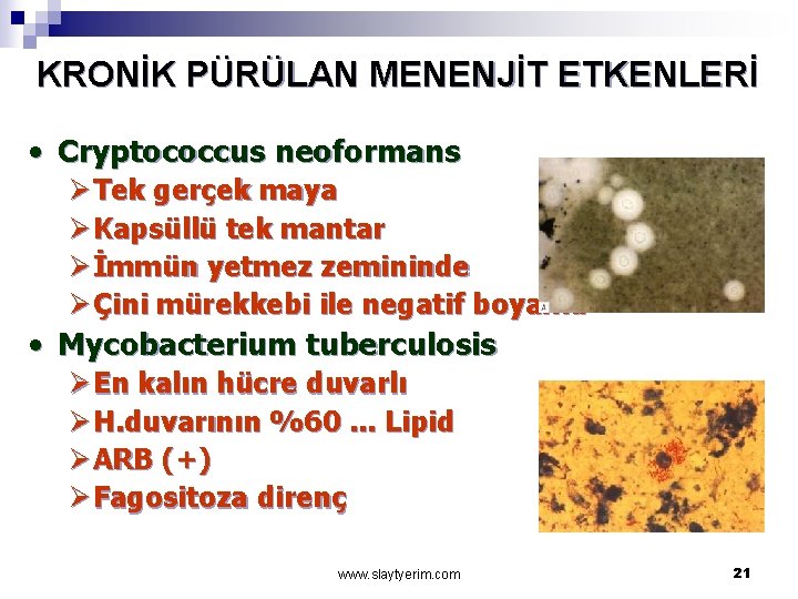 KRONİK PÜRÜLAN MENENJİT ETKENLERİ • Cryptococcus neoformans Ø Tek gerçek maya Ø Kapsüllü tek