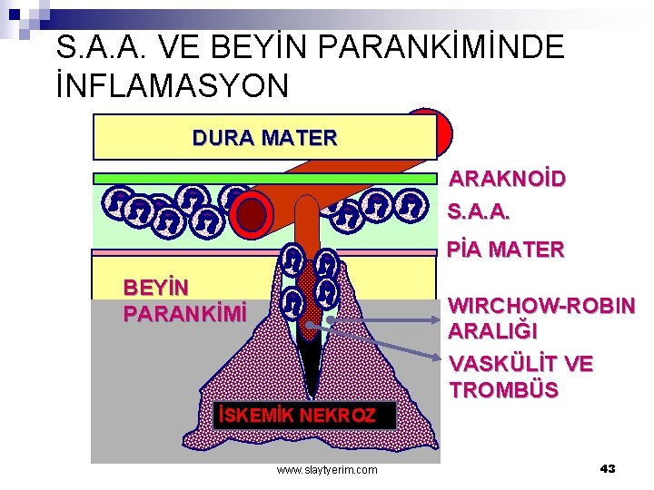 S. A. A. VE BEYİN PARANKİMİNDE İNFLAMASYON DURA MATER ARAKNOİD S. A. A. PİA