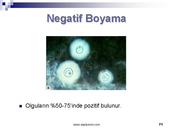 Negatif Boyama n Olguların %50 -75’inde pozitif bulunur. www. slaytyerim. com 71 