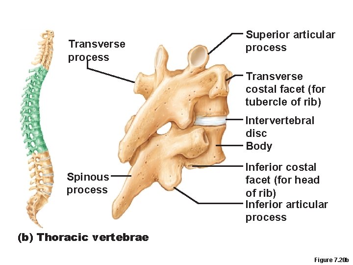 Transverse process Superior articular process Transverse costal facet (for tubercle of rib) Intervertebral disc