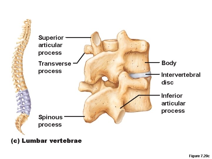 Superior articular process Transverse process Spinous process Body Intervertebral disc Inferior articular process (c)