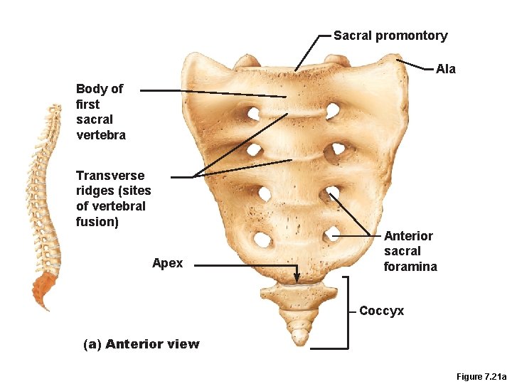 Sacral promontory Ala Body of first sacral vertebra Transverse ridges (sites of vertebral fusion)