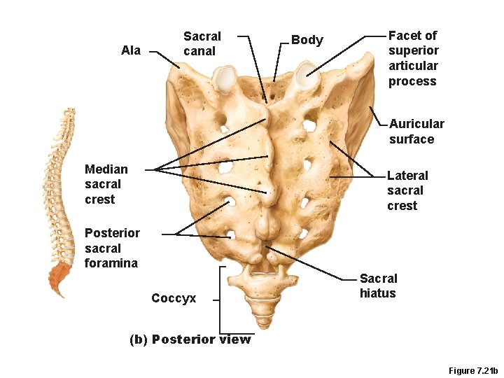 Ala Sacral canal Body Facet of superior articular process Auricular surface Median sacral crest