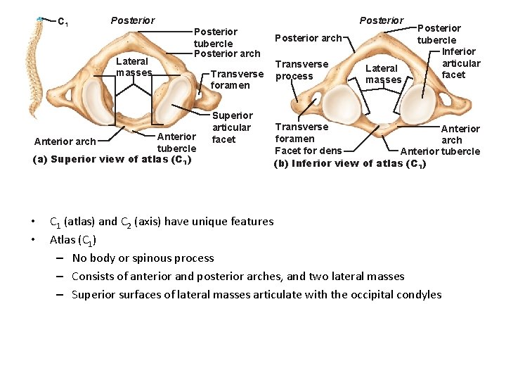 C 1 Posterior Lateral masses Posterior tubercle Posterior arch Anterior arch tubercle (a) Superior