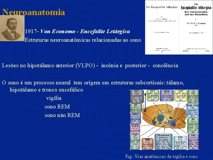 Neuroanatomia 1917 - Von Economo - Encefalite Letárgica Estruturas neuroanatômicas relacionadas ao sono Lesões