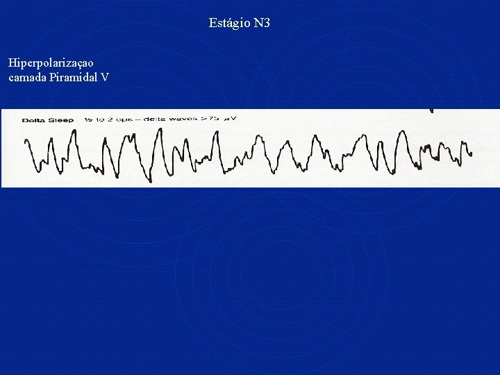 Estágio N 3 Hiperpolarizaçao camada Piramidal V 