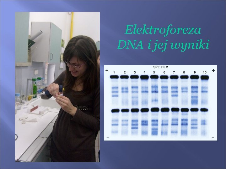 Elektroforeza DNA i jej wyniki 