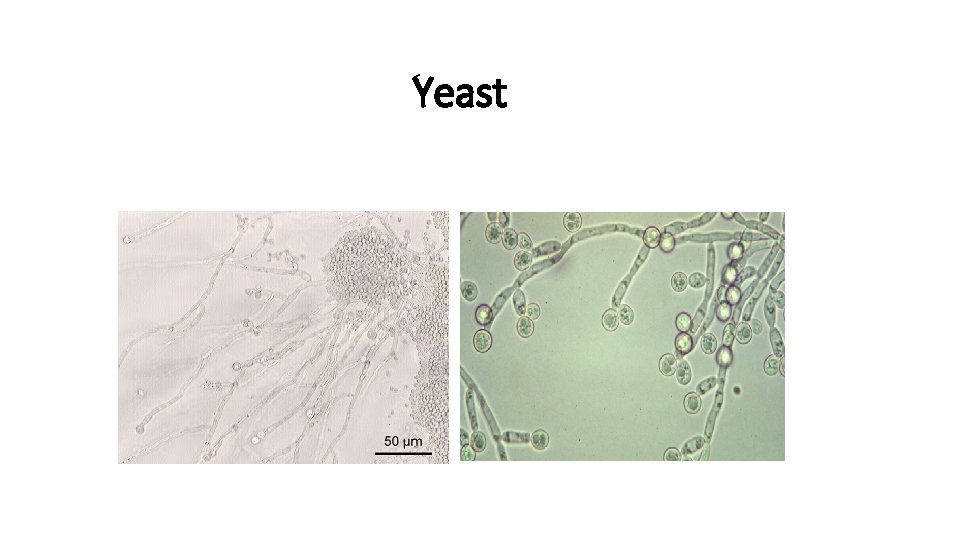 Yeast 