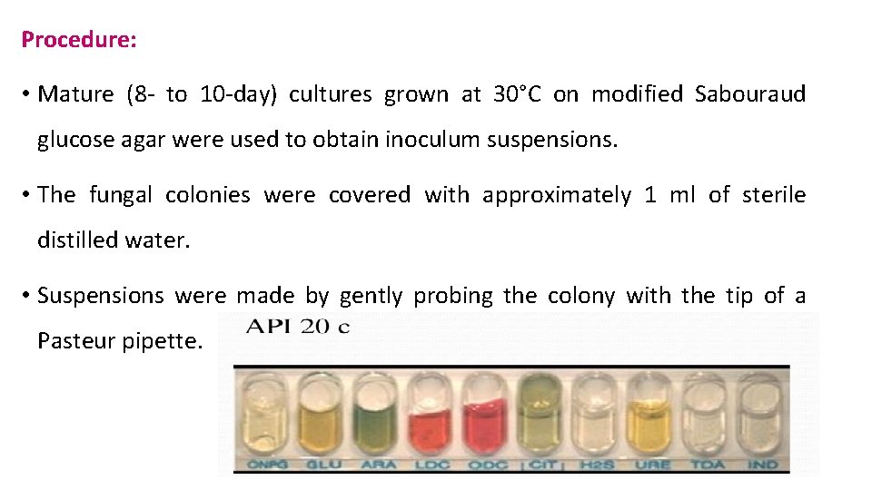 Procedure: • Mature (8 - to 10 -day) cultures grown at 30°C on modified